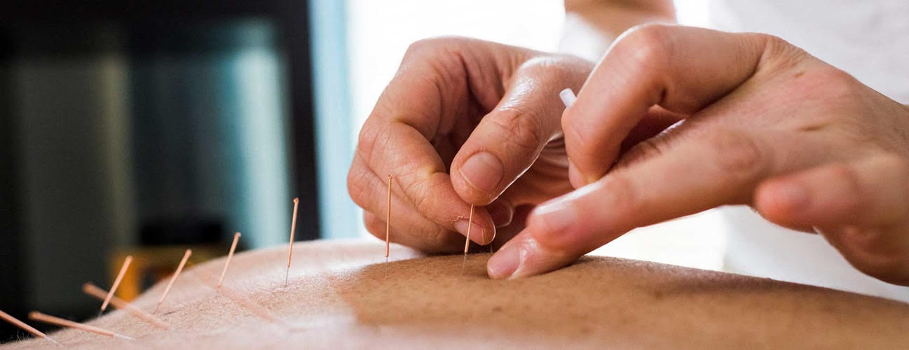 You are currently viewing Your Body Is Electric: How Acupuncture Taps Into Your Inner Current