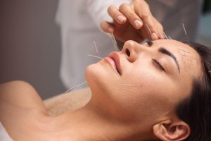 Read more about the article Facial Acupuncture: A Natural Alternative to Botox